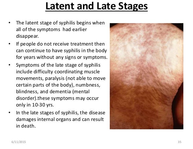 Second stage syphilis treatment with azithromycin Second stage syphilis treatment with azithromycin
